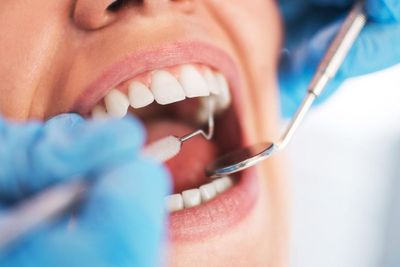 People are pulling their own teeth out due to lack of urgent NHS dental care