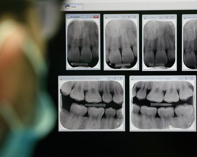 Dentists in England to be paid more for emergency NHS appointments