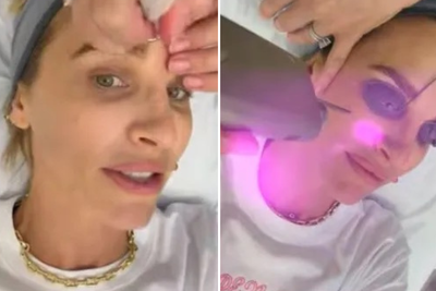 Vogue Williams undergoes ‘intense’ cosmetic procedures after ‘rotting’ on I’m A Celebrity