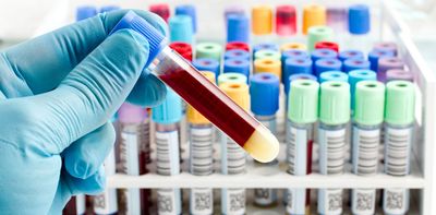 Your blood proteins could predict your risk of an early death