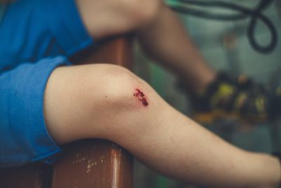 Why Wounds Heal Slowly: Key Nutrient Deficiencies and Diabetes Symptoms to Watch