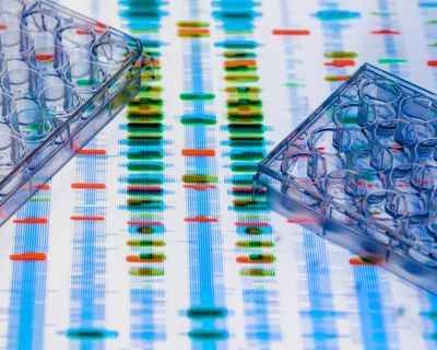 The Divided Mind by Edward Bullmore review – do we finally know what causes schizophrenia?