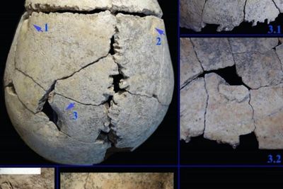 Prehistoric teenager defied odds to survive lion attack for months, study suggests