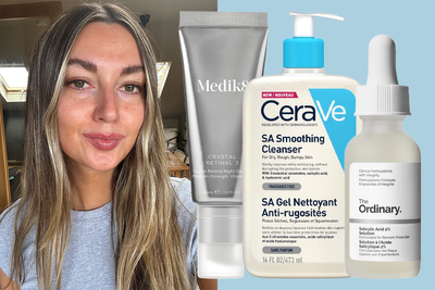 I spoke to a derm about adult acne – these are the three skincare ingredients she recommends