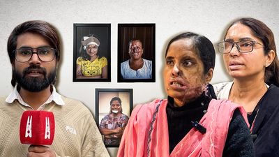 ‘They find our faces disturbing’: Acid attack survivor’s 16-year quest for justice and a home