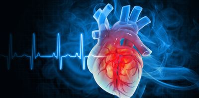 How C-reactive protein outpaced ‘bad’ cholesterol as leading heart disease risk marker