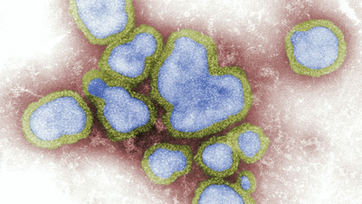 Super Flu Virus Hits US Ahead of Christmas, Increases Influenza Infections by Almost 500%