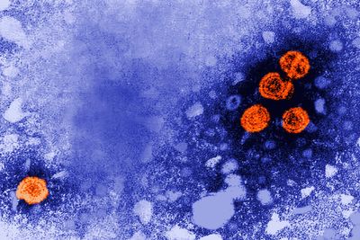 US awards no-bid contract to Denmark scientists studying hepatitis B vaccine in African babies