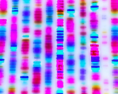 The Guardian view on gene editing: breakthroughs need a new social contract