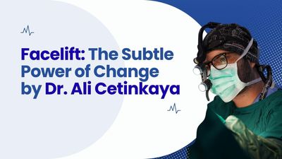 The Subtle Power of Change: Facelift Results by Dr. Ali Cetinkaya