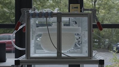 This ‘artificial womb’ could save the lives of extremely premature babies