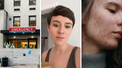 Georgia woman pops a pimple. Then she ends up in the ER: ‘Lesson learned’