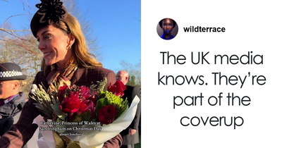 Kate Middleton Facial Scar Claims Ignite New Conspiracy Frenzy After Church Appearance