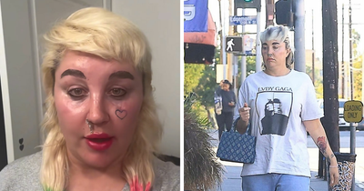 Amanda Bynes Opens Up About Using Injections After Paparazzi Pic Shows Dramatic Weight Loss