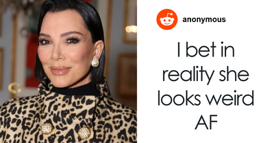 The Internet Is Divided After Kris Jenner Finally Exposes Her Hands Publicly After Viral Facelift
