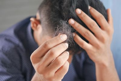 Why Male Hair Loss Happens: The Real Hair Thinning Reasons That Involves More Than Just Genetics