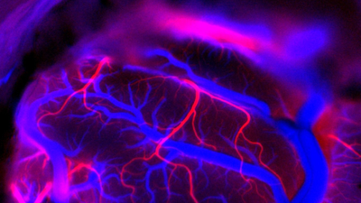 Elon Musk Wants To Make Neuralink Surgeries Fully Automated This 2026—Is This Safe?