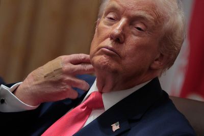 Trump lauds his ‘PERFECT HEALTH’ after report reveals hearing difficulties, skin and vein conditions