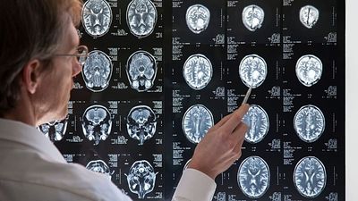 Why do some brains adapt to change faster than others? New study offers clues