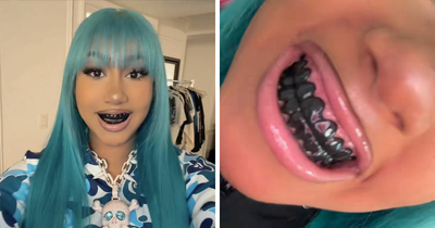 North West, 12, Shows Off New Piercings And Blackened Teeth In Video As Fans Slam Kim Kardashian