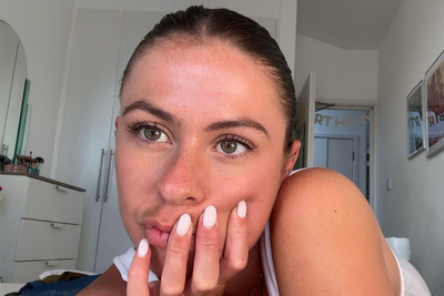 How high-risk Botox habits have become normalised for twentysomethings like me