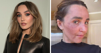 “Really Disturbing”: SNL Star Reveals “Botched” Cosmetic Procedures In Concerning Photos