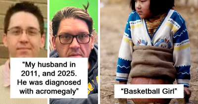 57 Fascinating And Unnerving Medical Photos Not Everyone Can Handle (New Pics)