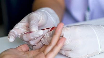 New finger-prick blood test could help detect Alzheimer's from a home-collected sample