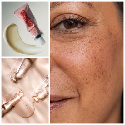 Why Tranexamic Acid Is Every Beauty Editor's Holy Grail Brightening Ingredient