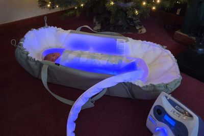 Newborns with jaundice treated at home in sleeping bag-style garment