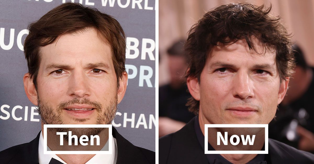 10 Stars Whose Dramatic Transformations Stunned Fans…