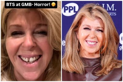 Kate Garraway in urgent dentist dash after breaking front teeth hours before going live on GMB