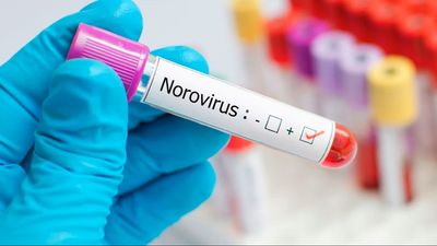 UKHSA Warns Norovirus Cases Have Jumped by Nearly Half in Two Weeks