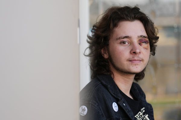 California protester left blind in one eye is among string of violent run-ins with federal agents