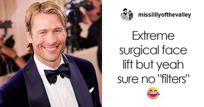 “Like A Plastic Robot”: Facialist Reveals What Celebrities Actually Did Before The Golden Globes