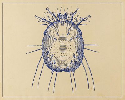 The sudden rise of scabies: ‘I wouldn’t wish it on my worst enemy’