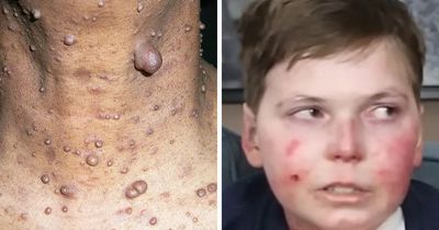 “Can’t Be Cured”: 38 Absolutely Heartbreaking Medical Conditions That No Person Deserves To Have