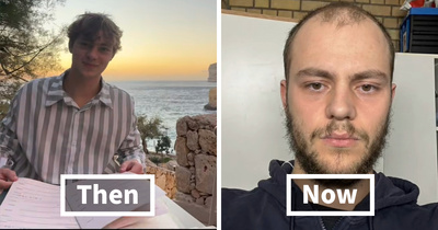 67 People Get Vulnerable By Sharing How They’ve Glowed Down Since They ‘Peaked’