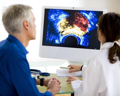 Prostate cancer is most commonly diagnosed cancer across UK, study finds