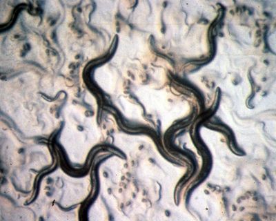 Does it even need to be said? No, you don’t need to do a ‘parasite cleanse’