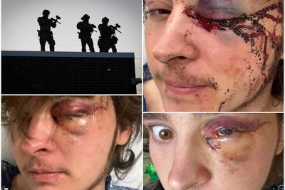ICE buys $100k worth of ‘non-lethal’ pepper ball rounds days after blinding protester with one