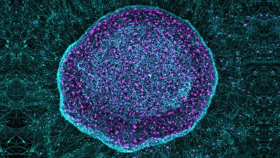 'Pain sponge' derived from stem cells could soak up pain signals before they reach the brain