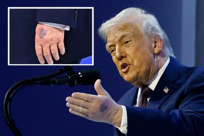 Trump says he takes ‘the big aspirin’ in defiance of medical advice as he explains dark new bruise on his left hand