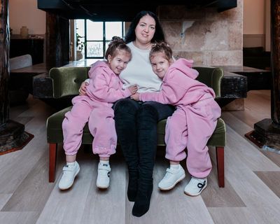 Experience: my daughters were born conjoined at the head