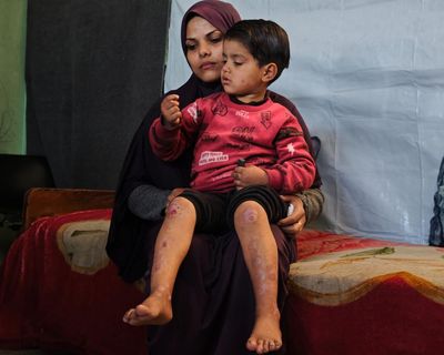 ‘I wish I had the power to ease his suffering’: Gaza’s cancer patients trapped by war and blockade