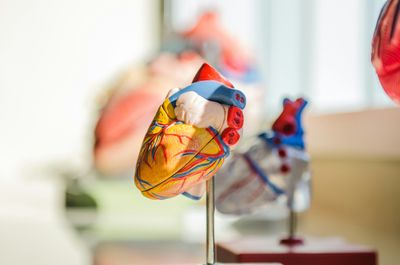 Atrial Fibrillation Explained: Key Symptoms, Common Triggers, and Stroke Risk