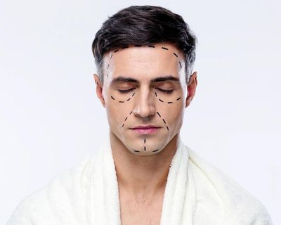 ‘Looksmaxxing’ young men are carving up their faces. Being ugly is a lot easier