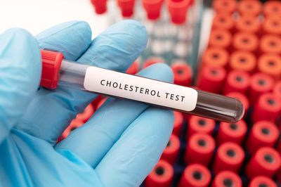 The 3 ways in which you could lower your cholesterol