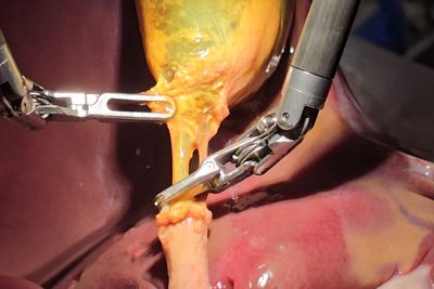 Surgeons can now operate on patients thousands of miles away