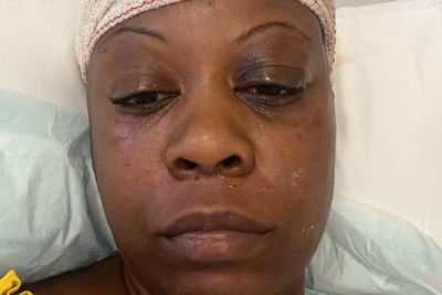 ‘I knew I had high blood pressure – but I never thought it would nearly kill me’